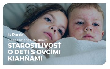Nadštandardná starostlivosť o deti s ovčími kiahňami: Biopeptide Serum Spray ako pomocník v hojení raniek